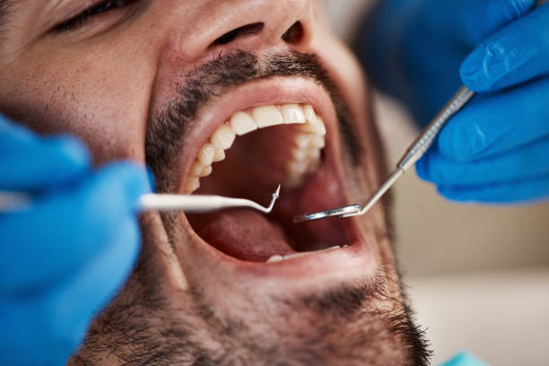 Best Dental Fillings (Composite and Amalgam)  in Monmouth, IL